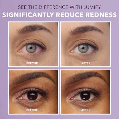 LUMIFY Redness Reliever Eye Drops - Energize Food Supplements Palestine